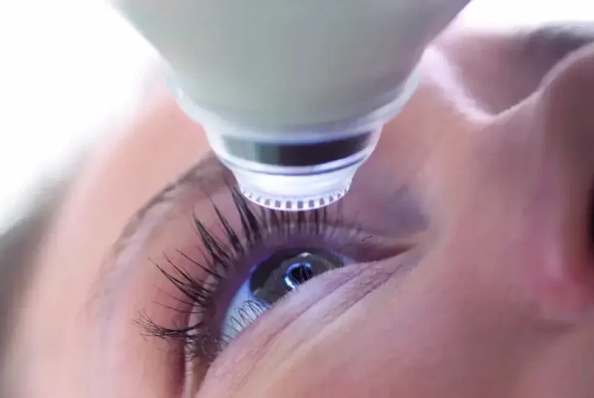 Chirurgie réfractive, centre de correction de la vision